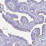 C4orf17 Antibody in Immunohistochemistry (Paraffin) (IHC (P))