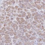 SIAH3 Polyclonal Antibody