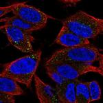 TVP23A Polyclonal Antibody