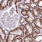 TVP23A Antibody in Immunohistochemistry (Paraffin) (IHC (P))