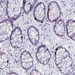 LCN15 Antibody in Immunohistochemistry (Paraffin) (IHC (P))