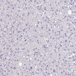 LCN15 Antibody in Immunohistochemistry (Paraffin) (IHC (P))