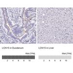 LCN15 Antibody in Immunohistochemistry (IHC)