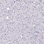 LCN15 Antibody in Immunohistochemistry (IHC)