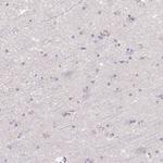 LPA Antibody in Immunohistochemistry (Paraffin) (IHC (P))