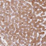 LPA Antibody in Immunohistochemistry (Paraffin) (IHC (P))