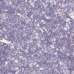LPA Polyclonal Antibody