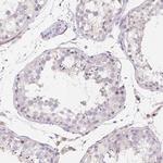 LPA Antibody in Immunohistochemistry (Paraffin) (IHC (P))