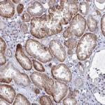 PLEKHG7 Polyclonal Antibody