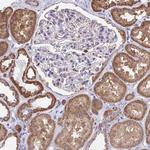 WBSCR16 Polyclonal Antibody