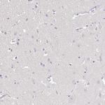 TIMELESS Antibody in Immunohistochemistry (Paraffin) (IHC (P))