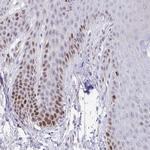 TIMELESS Antibody in Immunohistochemistry (Paraffin) (IHC (P))