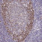TIMELESS Antibody in Immunohistochemistry (Paraffin) (IHC (P))