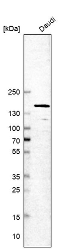 TIMELESS Antibody in Western Blot (WB)