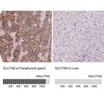 SLC7A8 Polyclonal Antibody