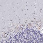 TAS2R39 Antibody in Immunohistochemistry (Paraffin) (IHC (P))