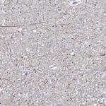 TAS2R39 Antibody in Immunohistochemistry (Paraffin) (IHC (P))