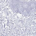 TAS2R39 Antibody in Immunohistochemistry (Paraffin) (IHC (P))