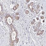 EHF Antibody in Immunohistochemistry (Paraffin) (IHC (P))