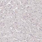 EHF Antibody in Immunohistochemistry (IHC)