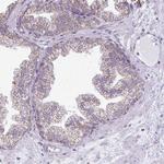 MPZL2 Antibody in Immunohistochemistry (Paraffin) (IHC (P))
