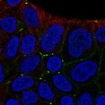 MPZL2 Polyclonal Antibody