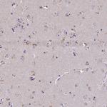 ZNF34 Antibody in Immunohistochemistry (Paraffin) (IHC (P))