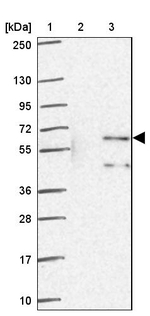 ZNF34 Antibody in Western Blot (WB)