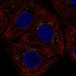 AIG1 Polyclonal Antibody