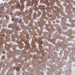 AIG1 Antibody in Immunohistochemistry (Paraffin) (IHC (P))