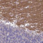 GALNT13 Antibody in Immunohistochemistry (Paraffin) (IHC (P))