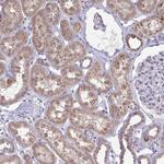 GALNT13 Antibody in Immunohistochemistry (Paraffin) (IHC (P))