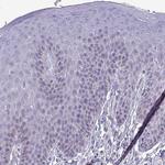 GALNT13 Polyclonal Antibody