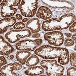 STARD8 Polyclonal Antibody