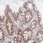 PDAP1 Polyclonal Antibody