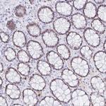 OR6T1 Polyclonal Antibody