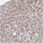 Alcohol Dehydrogenase 1A Antibody in Immunohistochemistry (Paraffin) (IHC (P))