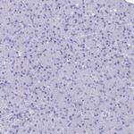 Alcohol Dehydrogenase 1A Antibody in Immunohistochemistry (Paraffin) (IHC (P))