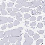 Alcohol Dehydrogenase 1A Antibody in Immunohistochemistry (Paraffin) (IHC (P))