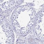 Alcohol Dehydrogenase 1A Polyclonal Antibody