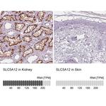 SLC5A12 Polyclonal Antibody