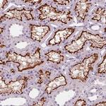 SLC5A12 Antibody in Immunohistochemistry (IHC)