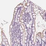 SLC5A12 Antibody in Immunohistochemistry (IHC)