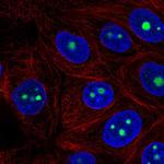 RRS1 Polyclonal Antibody