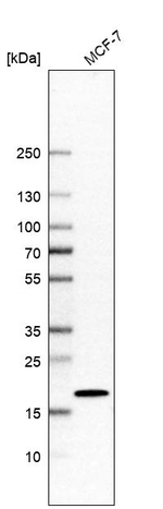 AP1S1 Antibody in Western Blot (WB)