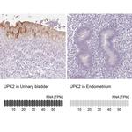 UPK2 Antibody in Immunohistochemistry (IHC)