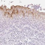UPK2 Antibody in Immunohistochemistry (IHC)