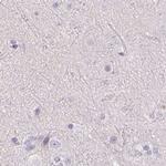 UPK2 Antibody in Immunohistochemistry (IHC)
