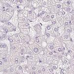 UPK2 Antibody in Immunohistochemistry (IHC)