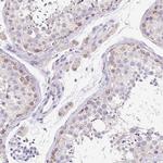 FKBP6 Antibody in Immunohistochemistry (IHC)